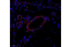 Immunofluorescence of paraffin embedded rat brain using Enfb3 (ABIN7073845) at dilution of 1: 600 (250x lens) (Ephrin B3 antibody)