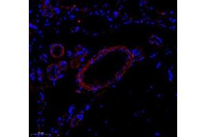 Immunofluorescence of paraffin embedded rat brain using Enfb3 (ABIN7073845) at dilution of 1: 600 (250x lens)