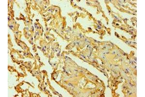 Immunohistochemistry of paraffin-embedded human lung tissue using ABIN7142626 at dilution of 1:100 (Serotonin Receptor 2B antibody  (AA 382-481))