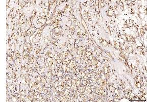 IHC analysis of NDUFB8 using anti-NDUFB8 antibody (ABIN7599048).