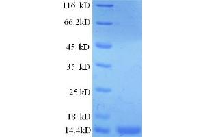 SDS-PAGE (SDS) image for Prostate Stem Cell Antigen (PSCA) (AA 21-95) protein (His tag) (ABIN4974534)