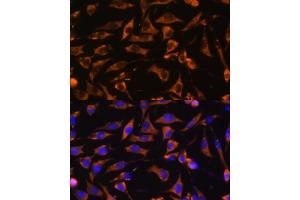 Immunofluorescence analysis of L929 cells using K antibody (ABIN7265613) at dilution of 1:100. (ANKRD15 antibody  (AA 900-1000))