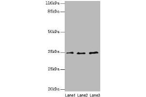 Western blot All lanes: AZGP1 antibody at 4 μg/mL Lane 1: PC-3 whole cell lysate Lane 2: HepG2 whole cell lysate Lane 3: K562 whole cell lysate Secondary Goat polyclonal to rabbit IgG at 1/10000 dilution Predicted band size: 35 kDa Observed band size: 35 kDa (AZGP1 antibody  (AA 61-210))