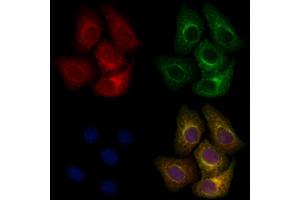 ABIN6263108 and ABIN6266800 staining Hela cells by IF/ICC. (MAP3K6 antibody  (C-Term))