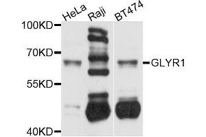 Western blot analysis of extracts of various cell lines, using GLYR1 antibody (ABIN5996127) at 1/1000 dilution. (GLYR1 antibody)