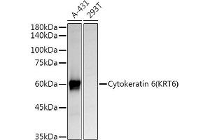Western blot analysis of extracts of various cell lines, using Cytokeratin 6 (KRT6) Rabbit pAb antibody (ABIN6129605, ABIN6143033, ABIN6143034 and ABIN6223467) at 1:1000 dilution. (KRT6A antibody  (AA 305-564))