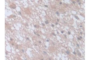 Immunohistochemistry (IHC) image for anti-Synaptosomal-Associated Protein, 23kDa (SNAP23) (AA 1-211) antibody (ABIN7444214)