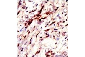 Image no. 2 for anti-Small Ubiquitin Related Modifier Protein 1 (SUMO1) antibody (ABIN356806) (SUMO1 antibody)