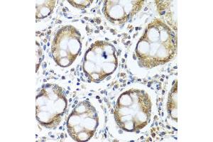 Immunohistochemistry of paraffin-embedded human colon using IFI44 antibody (ABIN5974803) at dilution of 1/100 (40x lens). (IFI44 antibody)