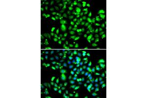 Immunofluorescence analysis of U20S cell using GBP1 antibody. (GBP1 antibody)