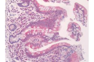 Immunohistochemistry (IHC) image for anti-Tumor Necrosis Factor Receptor Superfamily, Member 14 (TNFRSF14) (AA 60-283) antibody (ABIN2629400)