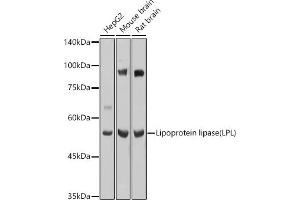 Western blot analysis of extracts of various cell lines, using Lipoprotein lipase (LPL) antibody (ABIN7268286) at 1:1000 dilution. (Lipoprotein Lipase antibody  (AA 124-475))