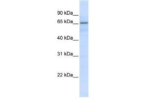 WB Suggested Anti-ZNF256 Antibody Titration:  0. (ZNF256 antibody  (N-Term))