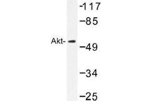 Image no. 1 for anti-V-Akt Murine Thymoma Viral Oncogene Homolog 1 (AKT1) antibody (ABIN317784) (AKT1 antibody)
