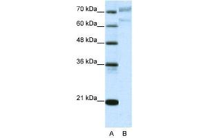 WB Suggested Anti-AATF  Antibody Titration: 5.