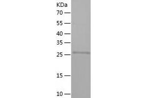 Western Blotting (WB) image for Heme Oxygenase (Decycling) 1 (HMOX1) (AA 1-261) protein (His tag) (ABIN7285064) (HMOX1 Protein (AA 1-261) (His tag))