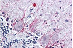 Brain, cerebellum, Human: Formalin-Fixed, Paraffin-Embedded (FFPE) (PTH2R antibody  (N-Term))
