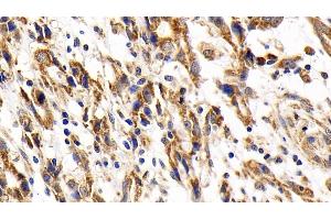 Immunohistochemistry (IHC) image for anti-Cytochrome C, Somatic (CYCS) (AA 13-99) antibody (ABIN7440230)