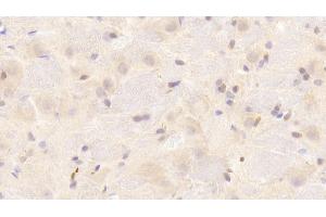 Detection of SNCa in Rat Cerebrum Tissue using Polyclonal Antibody to Synuclein Alpha (SNCa) (SNCA antibody  (AA 23-140))