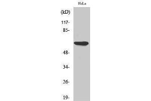 Western Blotting (WB) image for anti-Protein Kinase, AMP-Activated, alpha 1 Catalytic Subunit (PRKAA1) (Thr280) antibody (ABIN3183270) (PRKAA1 antibody  (Thr280))
