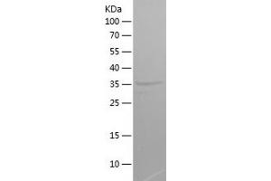 CXORF61 Protein (AA 22-113) (His-IF2DI Tag)