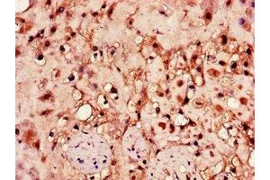 Immunohistochemistry of paraffin-embedded human placenta tissue using ABIN7155022 at dilution of 1:100 (HPSE antibody  (AA 263-523))