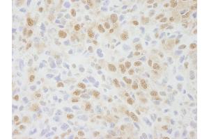 Immunohistochemistry (IHC) image for anti-Zinc Finger Protein 335 (ZNF335) (C-Term) antibody (ABIN7448692)