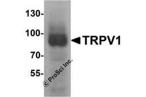 Western Blotting (WB) image for anti-Transient Receptor Potential Cation Channel, Subfamily V, Member 1 (TRPV1) (C-Term) antibody (ABIN1077423) (TRPV1 antibody  (C-Term))