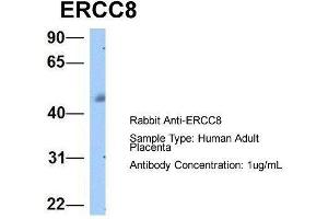 Host:  Rabbit  Target Name:  ERCC8  Sample Type:  Human Adult Placenta  Antibody Dilution:  1. (ERCC8 antibody  (C-Term))