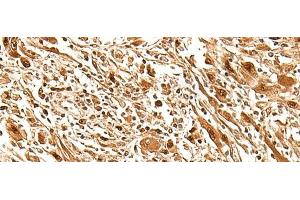 FIZ1 antibody