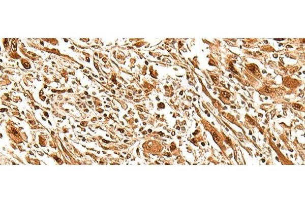 FIZ1 antibody