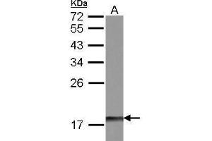 WB Image Sample (30 ug of whole cell lysate) A: IMR32 12% SDS PAGE antibody diluted at 1:500