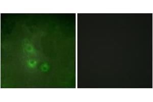 Immunofluorescence analysis of HuvEc cells, using FRK Antibody. (FRK antibody  (AA 71-120))