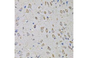 Immunohistochemistry of paraffin-embedded mouse brain using PTCD3 antibody. (PTCD3 antibody  (AA 450-689))