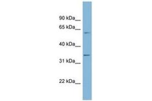 Image no. 1 for anti-O-Sialoglycoprotein Endopeptidase (OSGEP) (AA 143-192) antibody (ABIN6742054) (OSGEP antibody  (AA 143-192))