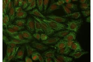 Immunocytochemistry staining of cytokeratin 18 in Hep-2 cells using mouse monoclonal antibody DA-7 ((ABIN94285), diluted 1:400), detected with GAM IgG-Alexa Fluor488 (diluted 1:200, green), cell nuclei stained with PI (1 μg/mL, orange). (Cytokeratin 18 antibody)