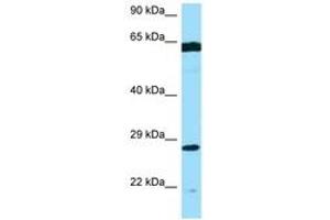 Image no. 1 for anti-Phosphomannomutase 2 (PMM2) (AA 120-169) antibody (ABIN6748475)
