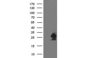 HEK293T cells were transfected with the pCMV6-ENTRY control (Left lane) or pCMV6-ENTRY HSPB7 (Right lane) cDNA for 48 hrs and lysed. (HSPB7 antibody)