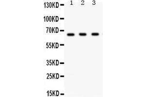 Western Blotting (WB) image for anti-Checkpoint Kinase 2 (CHEK2) (AA 465-498), (C-Term) antibody (ABIN3043811)