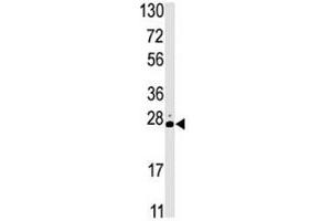 Western blot analysis of STK19 antibody and HL-60 lysate. (STK19 antibody  (AA 278-308))