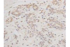 Immunohistochemistry (Paraffin-embedded Sections) (IHC (p)) image for anti-B-Cell CLL/lymphoma 2 (BCL2) antibody (ABIN1112797) (Bcl-2 antibody)