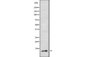 Western blot analysis of COX82 using 293 whole cell lysates (COX8A antibody  (Internal Region))
