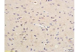 Formalin-fixed and paraffin embedded rat brain labeled with Anti SDHD Polyclonal Antibody, Unconjugated (ABIN751918) followed by conjugation to the secondary antibody and DAB staining (SDHD antibody  (AA 81-159))