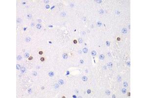Immunohistochemistry of paraffin-embedded Rat brain using TKT Polyclonal Antibody at dilution of 1:100 (40x lens).