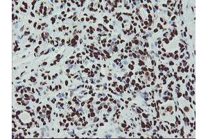 Immunohistochemical staining of paraffin-embedded Human breast tissue using anti-NONO mouse monoclonal antibody. (NONO antibody  (AA 184-385))