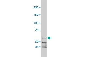 Western Blotting (WB) image for anti-P21-Activated Kinase 1 (PAK1) (AA 191-280) antibody (ABIN598852) (PAK1 antibody  (AA 191-280))