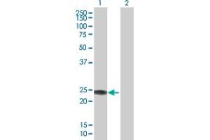 Western Blot analysis of IFNA14 expression in transfected 293T cell line by IFNA14 MaxPab polyclonal antibody.