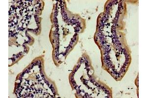 Immunohistochemistry of paraffin-embedded human small intestine tissue using ABIN7154035 at dilution of 1:100 (ENPEP antibody  (AA 719-949))