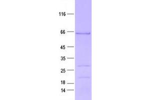 Validation with Western Blot