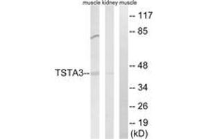 Western blot analysis of extracts from rat kidney/rat muscle cells, using TSTA3 Antibody. (TSTA3 antibody  (AA 221-270))